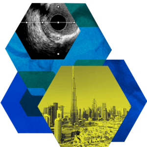 Live case1 - Serie - September 2nd, Dubai